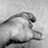 VascularHand